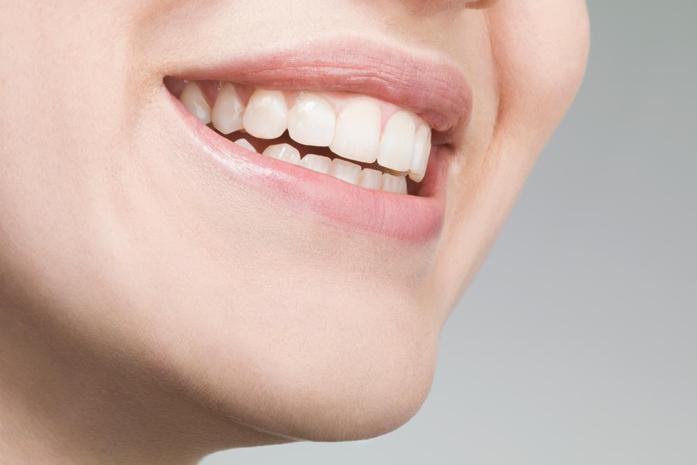 Leende mun som visar rena och fina tänder efter airflowbehandling